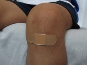 Skadestånd – beräkning av personskada
